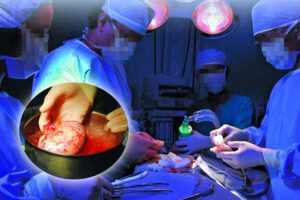 Organ Trafficking : किडनी के सौदागर
